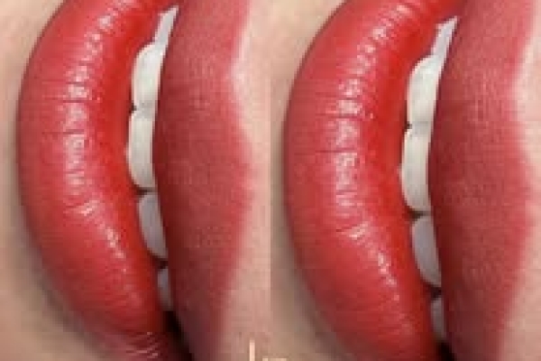 KHÓA HỌC KỸ THUẬT ĐI SỢI – KIM 1RL & 3RL